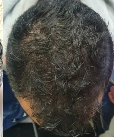 Gadiel posteriormente