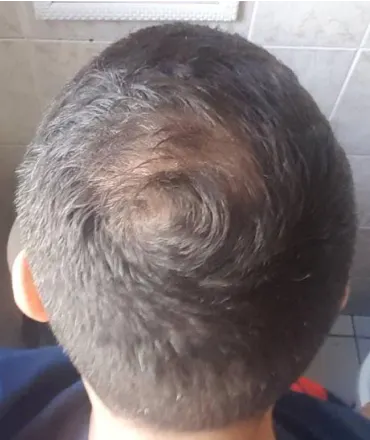 Henrique posteriormente ao tratamento